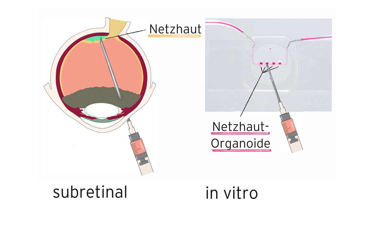 Grundlagenforschung: Retina-on-Chip-Systeme zum Testen von Gentherapien für Netzhauterkrankungen