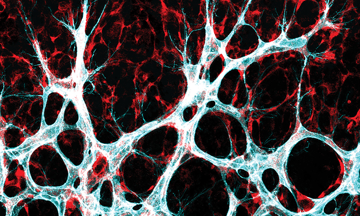 Wachsendes Blutgefäßnetzwerk in der Netzhaut: Endothelzellen (türkis/weiß) – wandern in das umgebende Gewebe ein, um dort neue Verbindungen zu bilden. Foto: Michael Potente, MDC