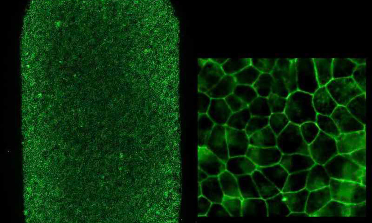 Links: RPE-Patches (2 x 4 mm). Jeder Punkt ist eine RPE-Zelle. Jeder Patch enthält ca. 75.000 RPE-Zellen. Rechts: RPE-Zellen bei höherer Vergrößerung. Bild: K. Bharti, Ph.D., NEI