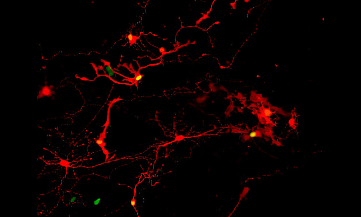 Rotfärbung der aus Stammzellen gezüchteten Netzhautzellen durch ein modifiziertes Tollwutvirus, das über die Synapsen übertragen wird. Bild. UW–Madison / Gamm Laboratory