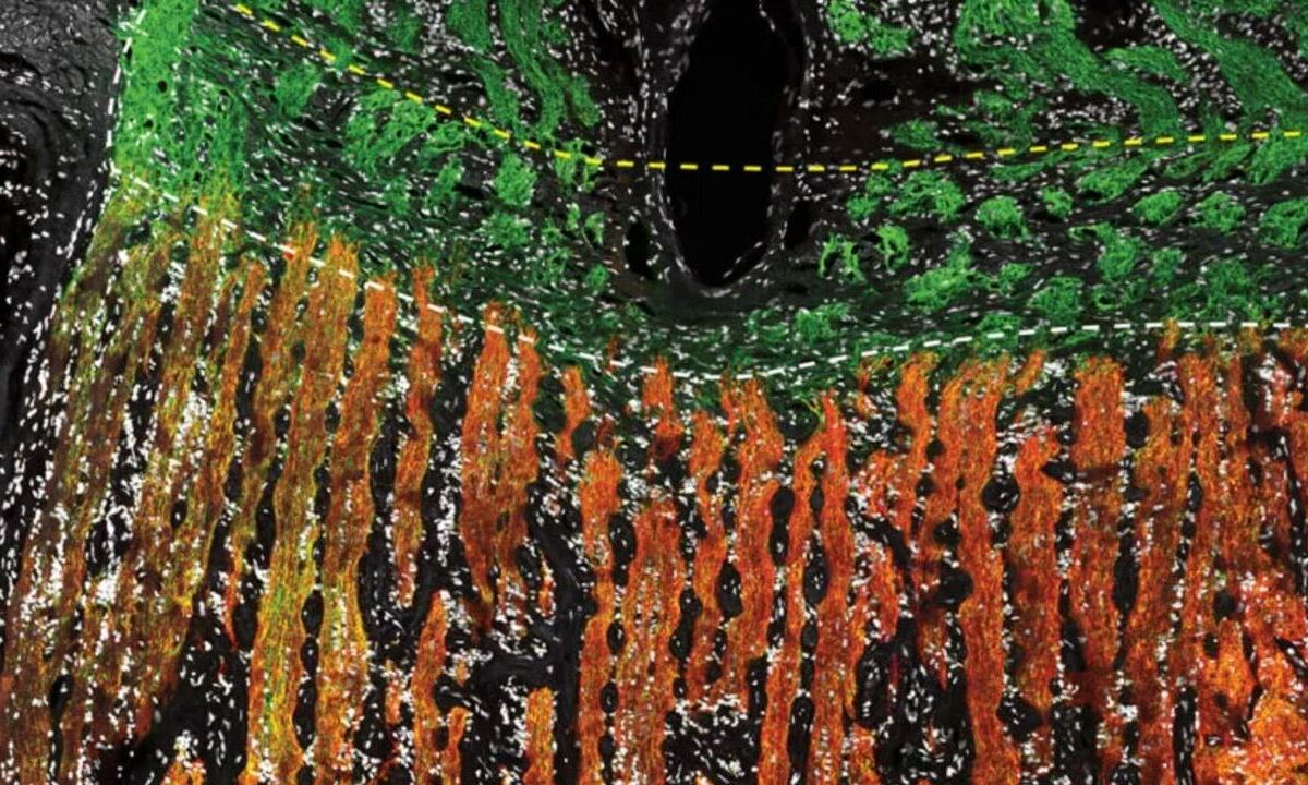 Harvard-Forscher erstellen vollständigen Zellatlas des menschlichen Auges