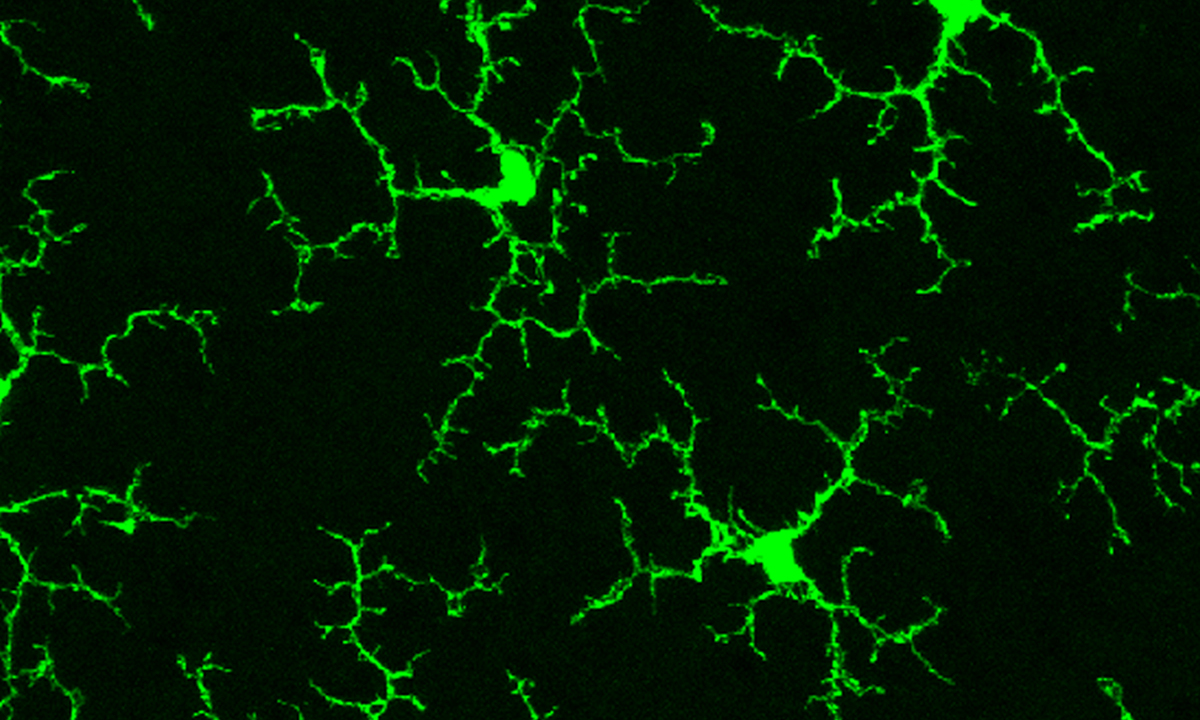 Mikroglia in einer Maus-Retina. Bild: Wai T. Wong, National Eye Institute, NIH