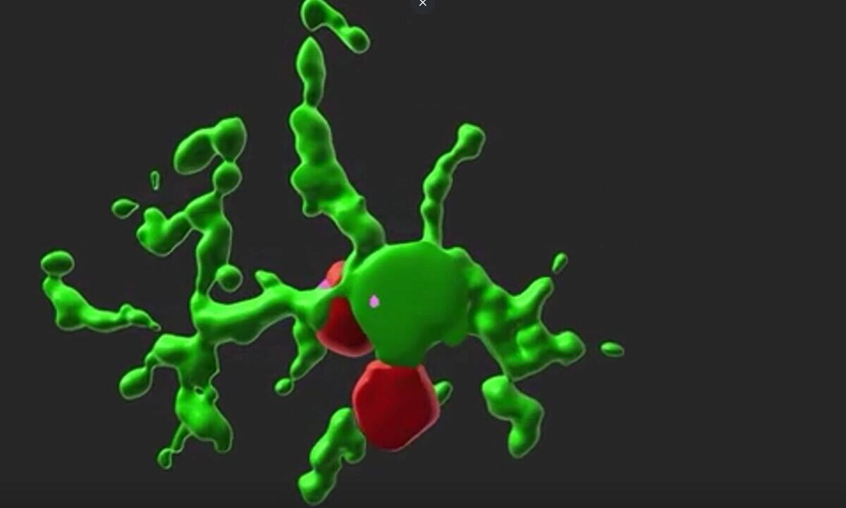 3D-Ansicht der Kontaktprofile (rosa) zwischen Mikroglia (grün) und amakrinen Zellen (rot) in der Retina eines STZ-induzierten Mausmodells. Bild: Washington University