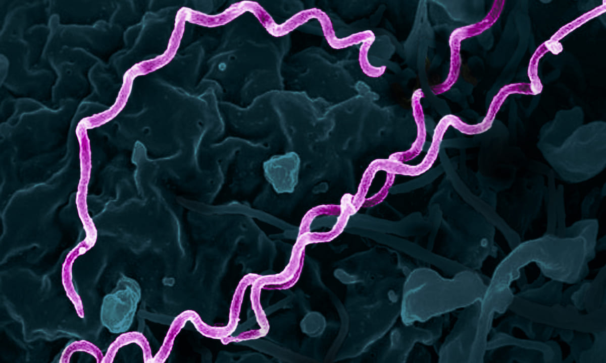 Kolorierte elektronenmikroskopische Aufnahme von Treponema pallidum, dem Bakterium, das Syphilis verursacht. Bild: National Institute of Allergy and Infectious Diseases