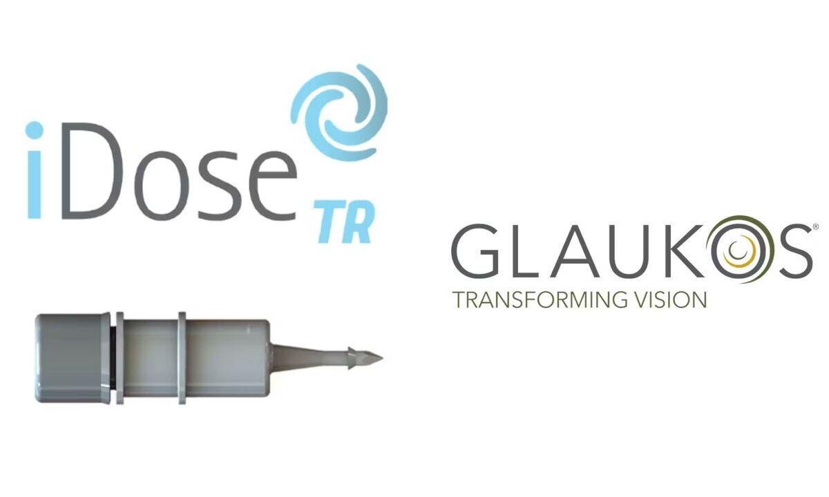 Glaukos verkündet FDA-Zulassung von iDose® TR (Travoprost-Intrakameral-Implantat)