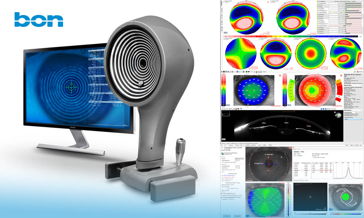 SIRIUS+: Das hochpräzise Hornhaut-Topographie und -Tomographiesystem  mit außergewöhnlich schneller Bilderfassung