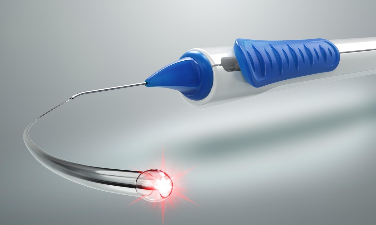 Die iTrack™-Kanaloplastik wird auf dem Internationalen Kongress der Deutschen Ophthalmochirurgie (DOC) 2024 vorgestellt