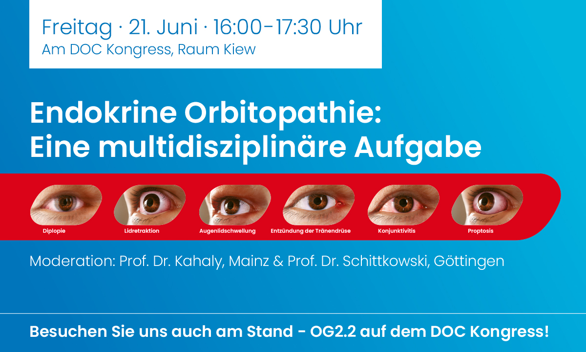 Erstes Symposium zum Thema „Endokrine Orbitopathie - eine multidisziplinäre Aufgabe“ von Amgen in Nürnberg am DOC Kongress