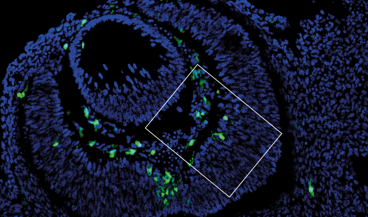 Schnitt durch sich entwickelndes Mausauge. Modifiziert nach Rosmus et al., J. Neuroinflammation 2024 (lizensiert nach Creative-Commons CC-BY-4.0).