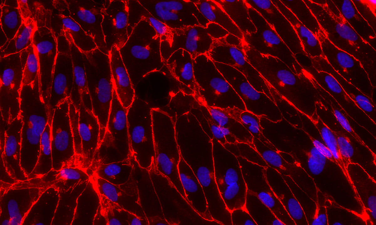 Immunfluoreszenzaufnahme: Aus ETV2 iso2 hiPSCs differenzierte Endothelzellen (rot), Zellkerne (blau).. S. Rieck. UKB / Institut für Physiologie 1