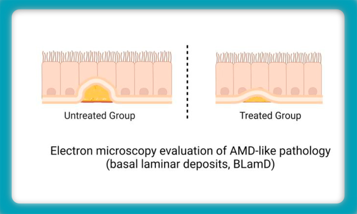 Potential new pathway to prevent age-related macular degeneration