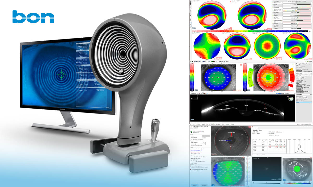 SIRIUS+: Das hochpräzise Hornhaut-Topographie und -Tomographiesystem mit außergewöhnlich schneller Bilderfassung