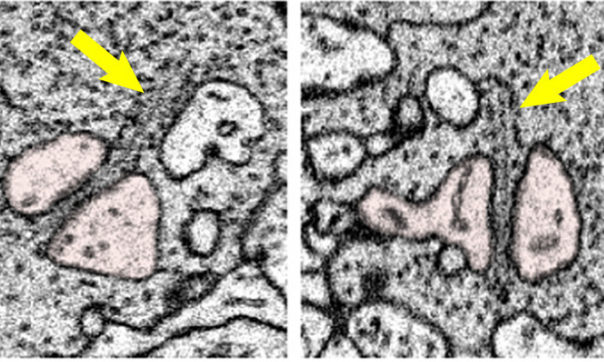 Communication between retinal cells: Swiss scientists solve a 50-year-old mystery