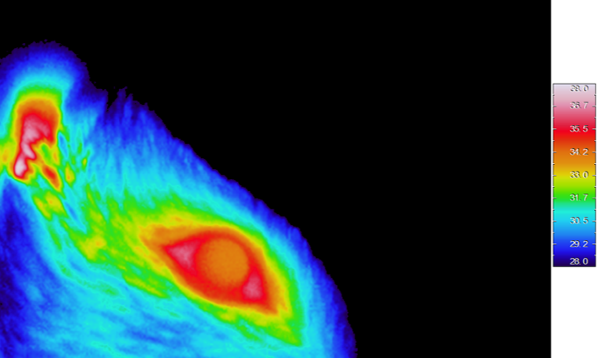 Study provides the first anatomical and functional representation of the ocular surface in the central nervous system