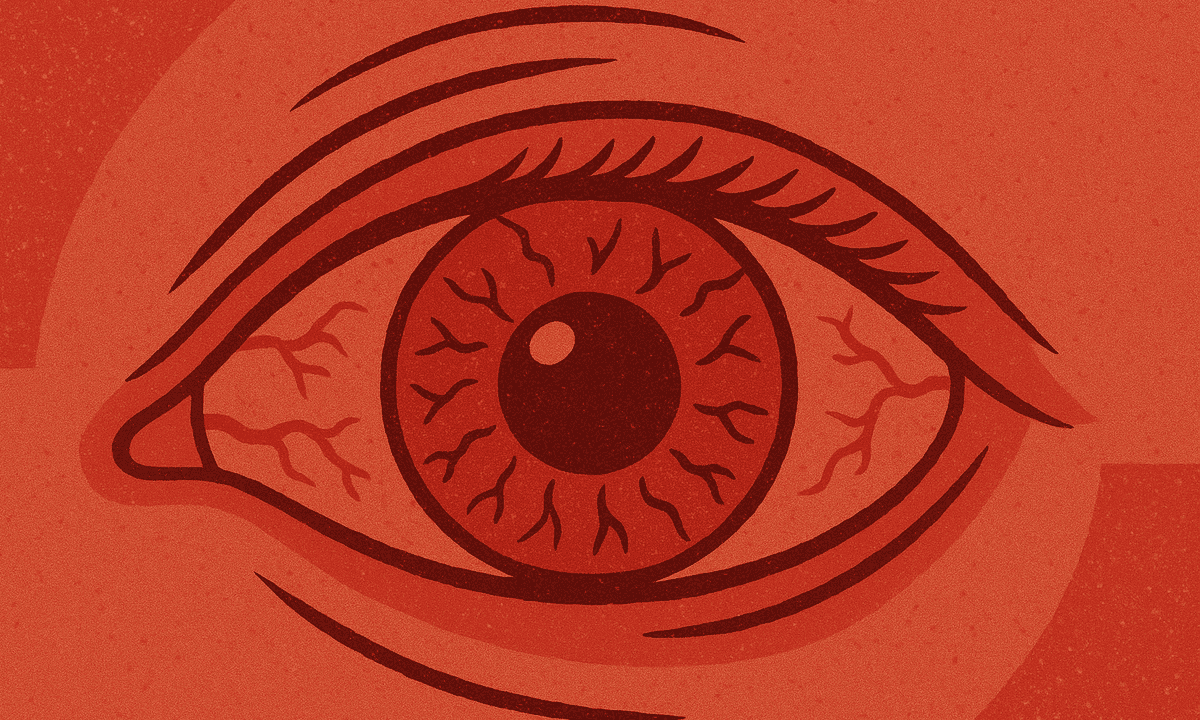 Uveitis kompakt: Anamnese & Diagnostik auf einen Blick