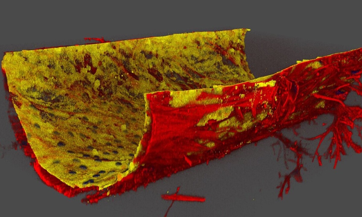 Novel 3D model reveals trigger for steroid-induced glaucoma