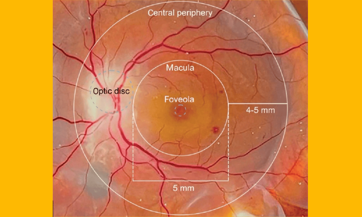 Infrared light for blind retina: Engineered human channels open a new path
