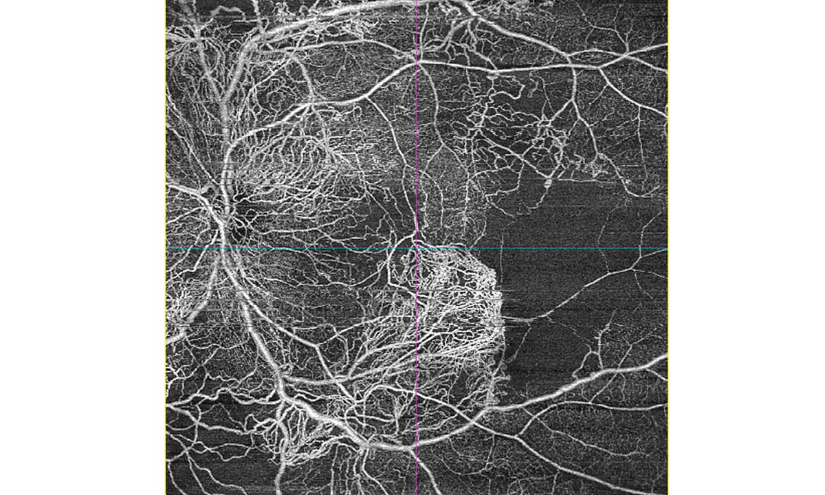 ZEISS präsentiert erweitertes DORC-Portfolio und neueste Softwareversionen