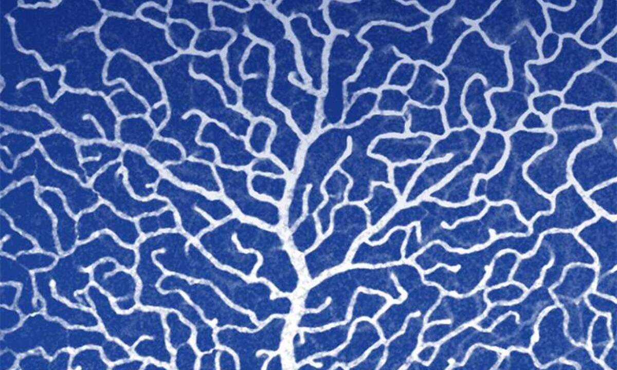 Early trigger of diabetic retinopathy identified