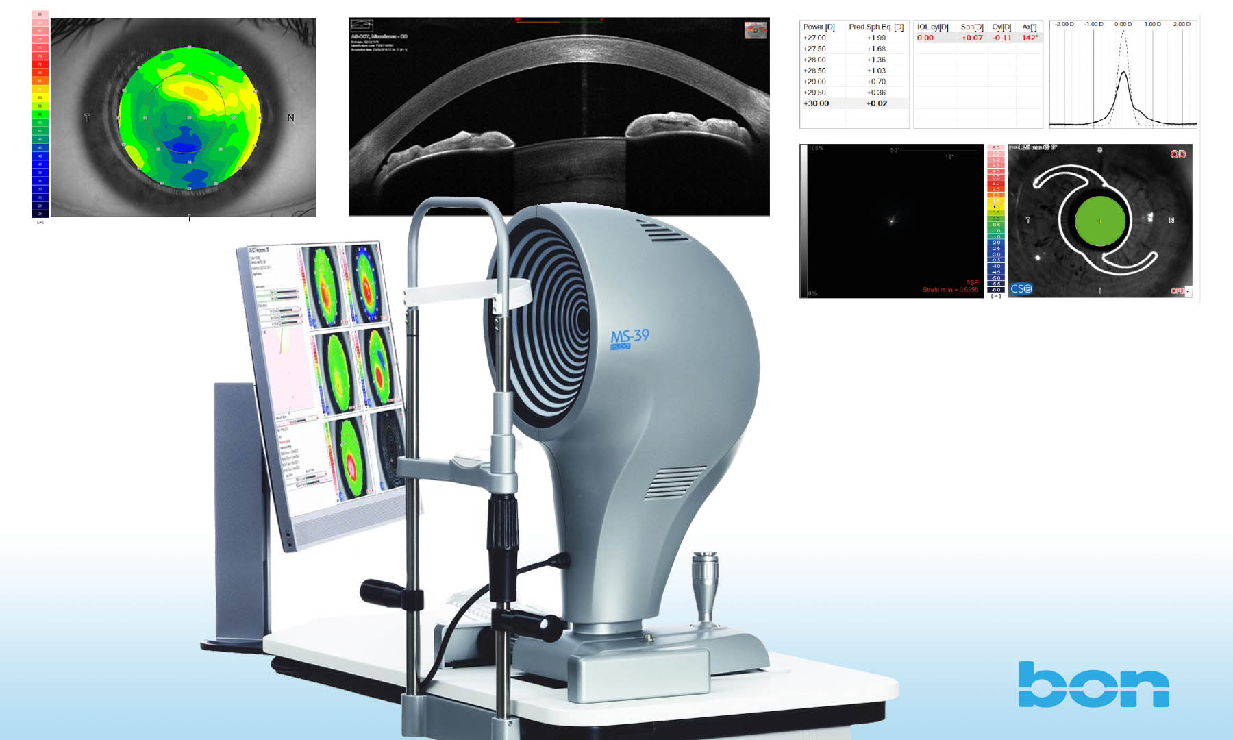 Das „Placido-OCT“ löst die Scheimpflugtechnik ab