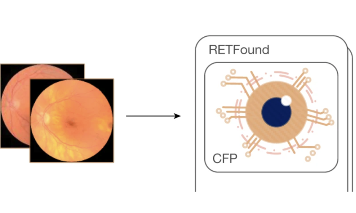AI Foundation Model for Generalizable Disease Detection from Retinal Images