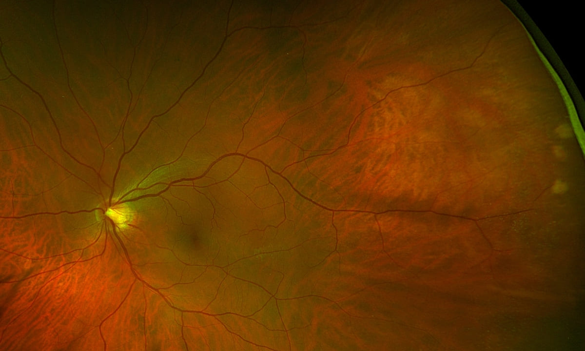 Virtual retina:  Could it help to unlock new treatments for vision loss?