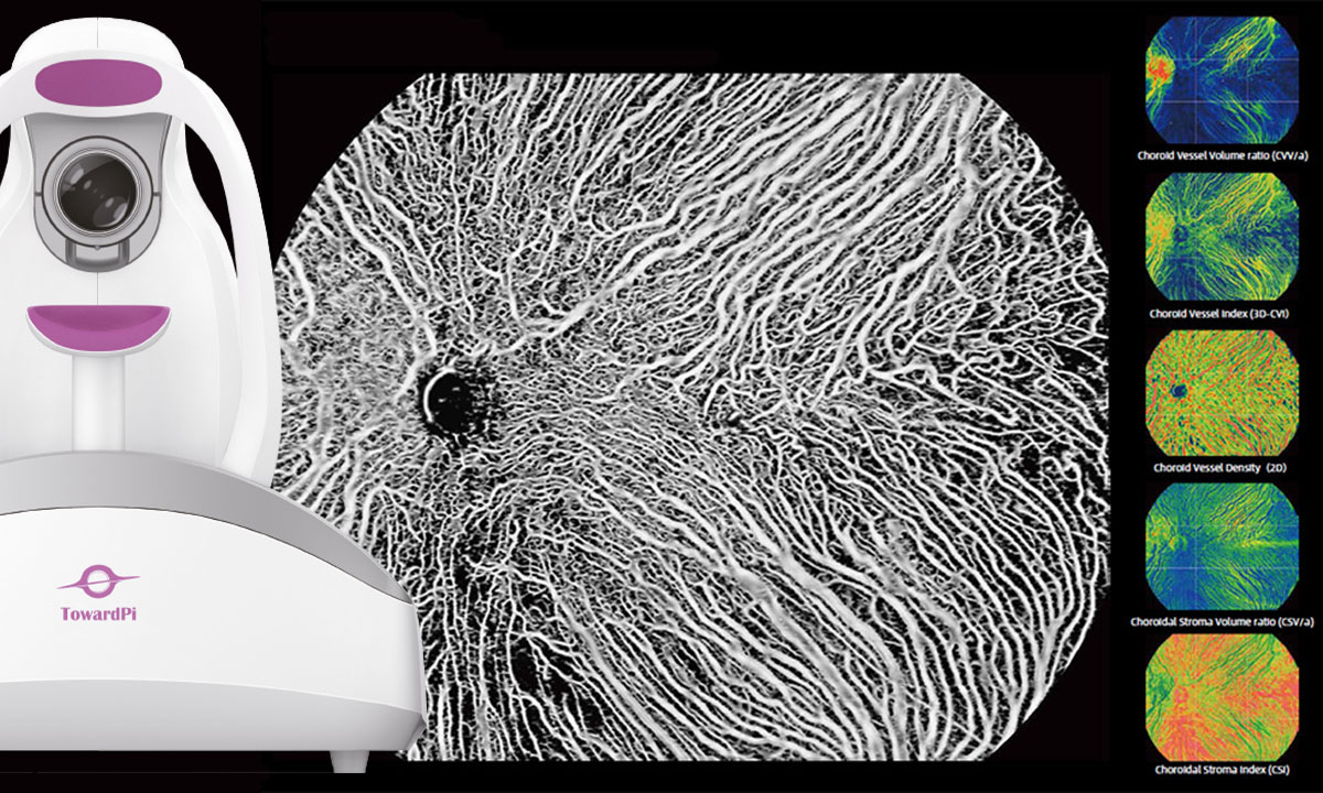 „BMizar“ - der neue Maßstab in der SS-OCT-Technik