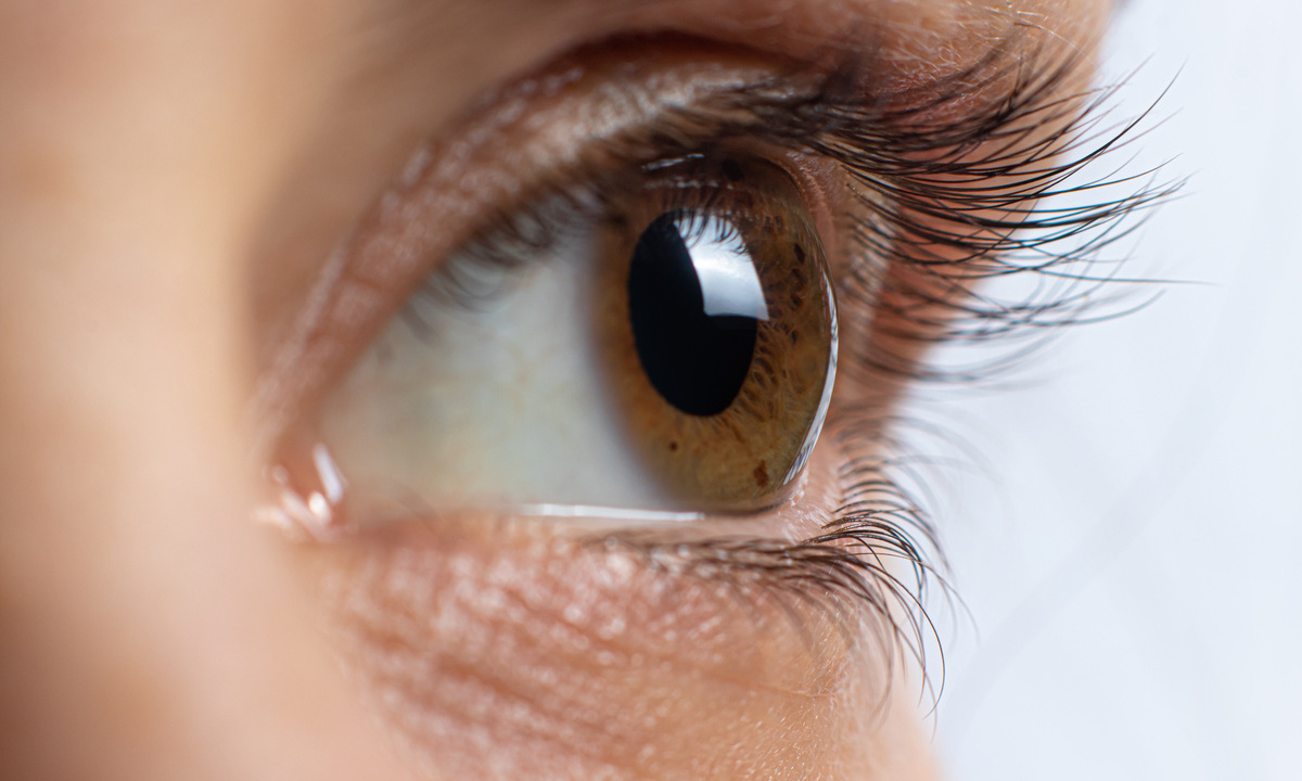 Aktualisierter „Global Consensus on Keratoconus“ erschienen