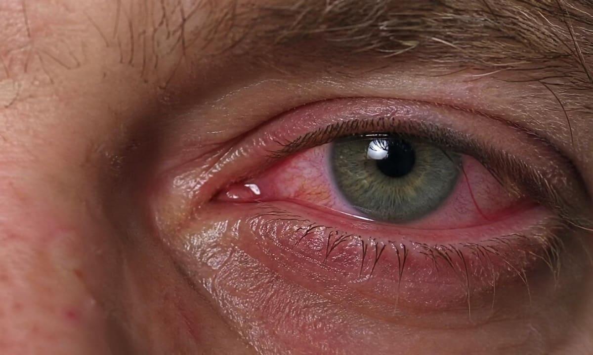 Augenärzteschaft kritisiert deutlich Teile des ABDA-Positionspapiers zur Primärversorgung