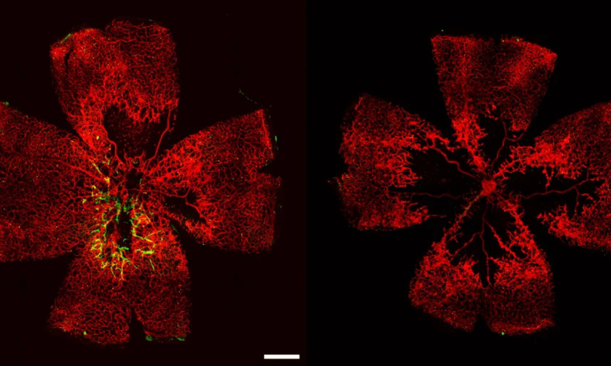 Lab-Grown Retinal Cells Show Promise for New Eye Therapies