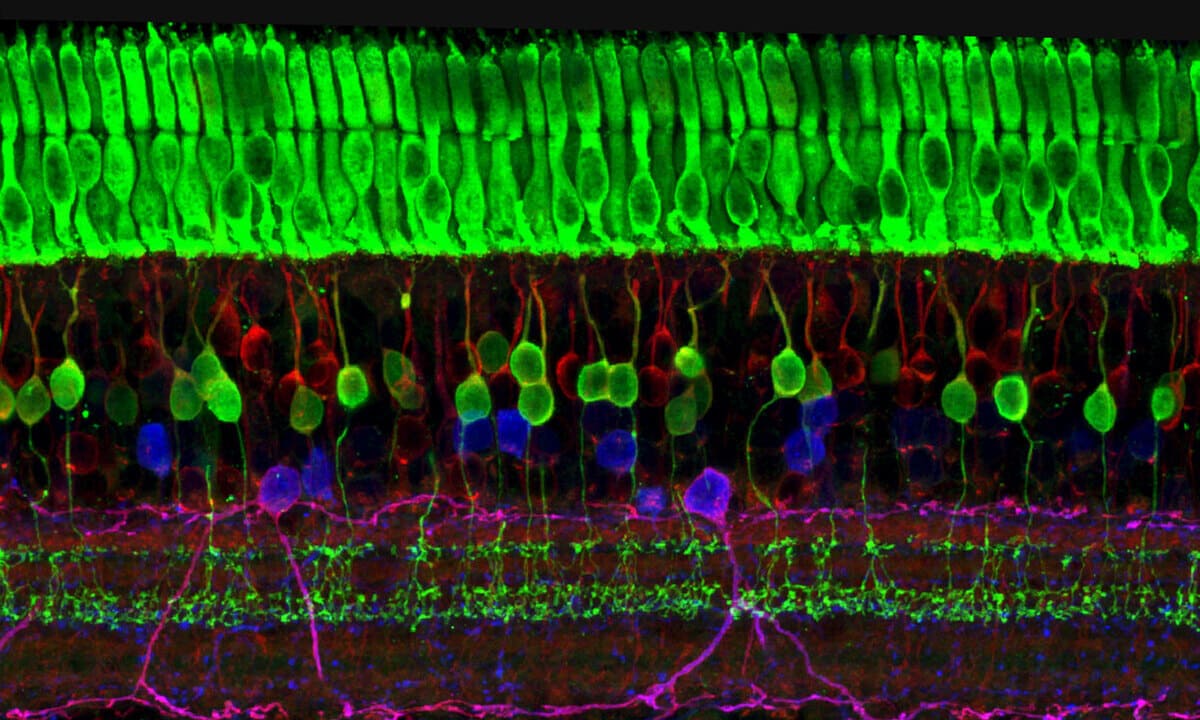 First large-scale database of cone photoreceptor cell size in the living human eye