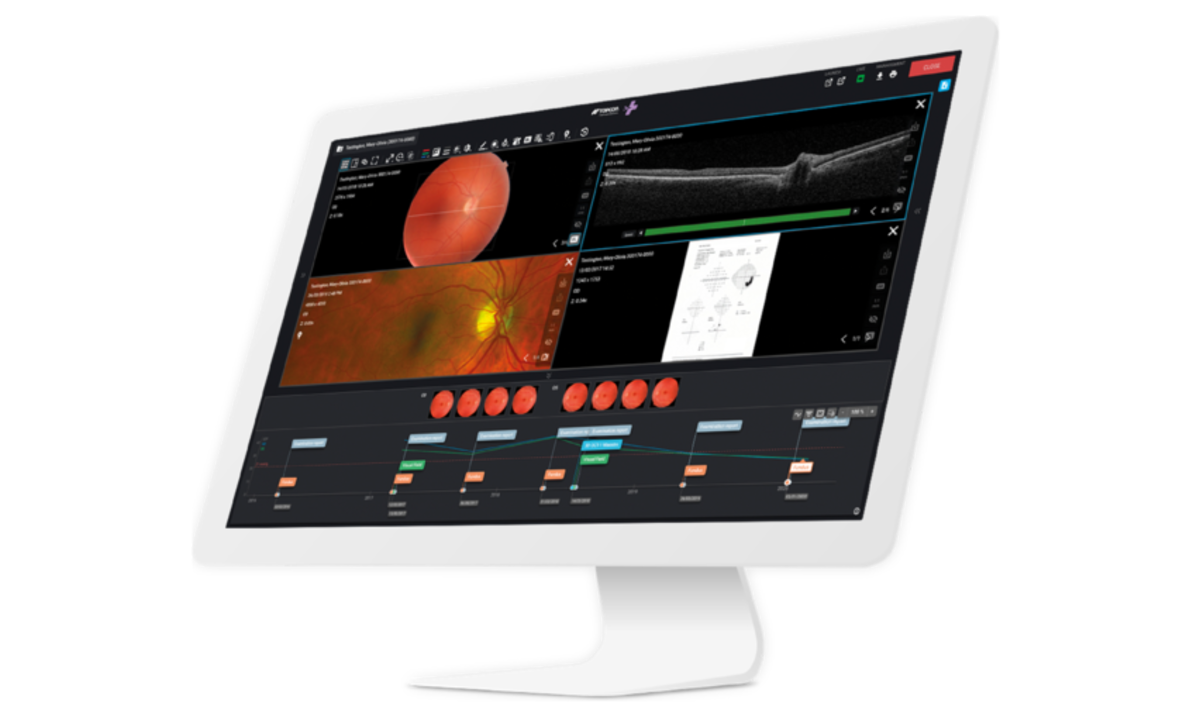 Topcon Healthcare Launches Harmony with Glaucoma Screening Decision Support in EMEA