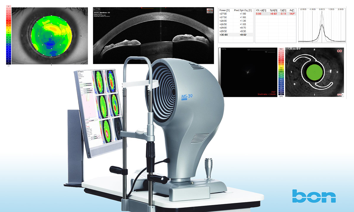 Das Placido-OCT - für bessere OP-Planung