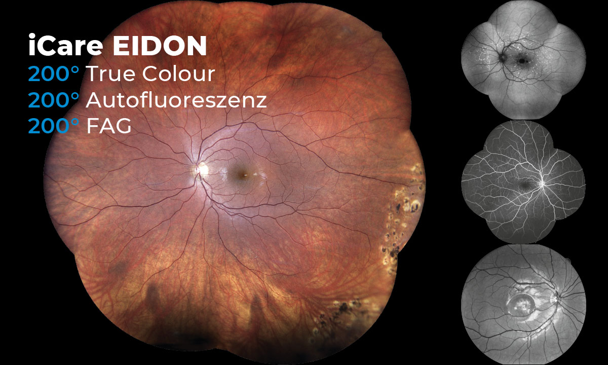 Konfokale Ultra-Widefield Bildgebung - vollautomatisch bis 200°