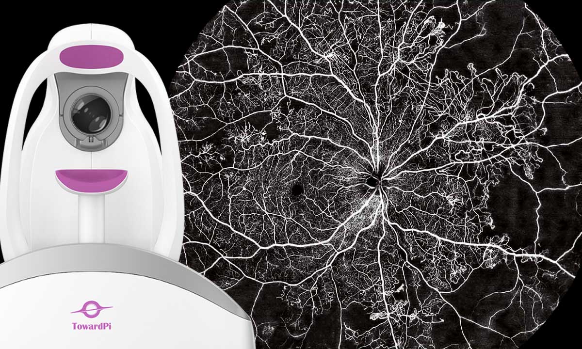 24 x 20 mm Ultra-Wide OCT-A – Ist das zu groß für Sie?