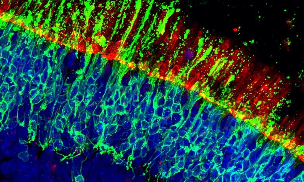 Was hält unsere Sehzellen am Leben? Erkenntnisse aus 20.000 Netzhaut‑Organoiden