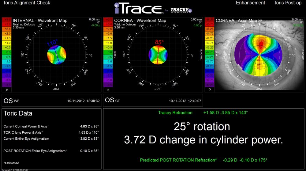iTRACE™ | Tracey Technologies | Produkt