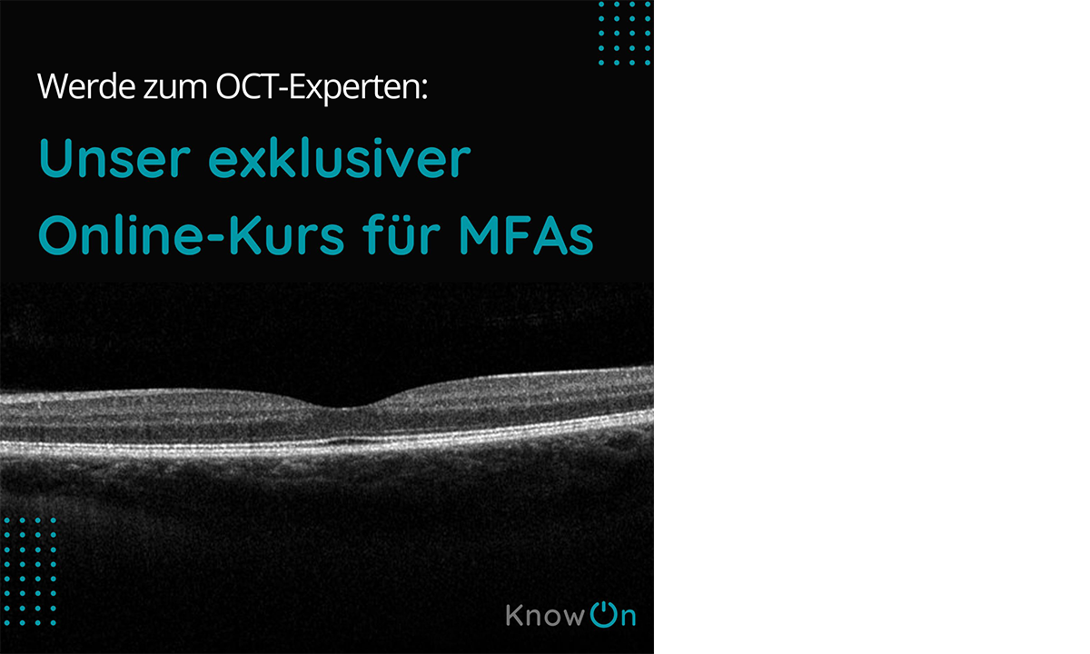 🔥🌟 Neues Format: Erstes Live-Webinar von KnowOn für Augenarztpraxen!