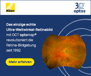 Optos_Ultra-Weitwinkel-Retinabild